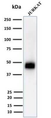 Western Blot: CD2 Antibody (UMCD2) [NBP2-32815]