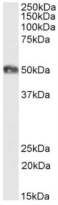 Western Blot: CD2 Antibody (YTH 655)ChimericAzide and BSA Free [NBP2-81041]