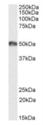 Western Blot: CD2 Antibody (YTH 655)Azide and BSA Free [NBP2-81042]