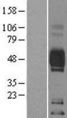 Western Blot: CD2 Overexpression Lysate [NBL1-08916]