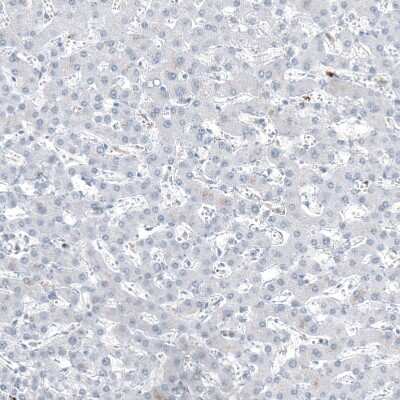 Immunohistochemistry-Paraffin: CD20 Antibody (CL10613) [NBP3-07979]