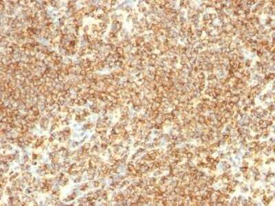 Immunohistochemistry-Paraffin: CD20 Antibody (IGEL/773) - Azide and BSA Free [NBP2-47840]