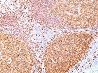 Immunohistochemistry-Paraffin: CD20 Antibody (IGEL/773) - IHC-Prediluted [NBP2-48335]