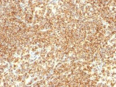 Immunohistochemistry-Paraffin: CD20 Antibody (IGEL/773) - IHC-Prediluted [NBP2-48335]