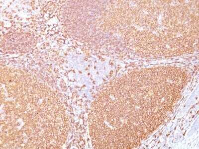 Immunohistochemistry-Paraffin: CD20 Antibody (IGEL/773) [NBP2-44745]