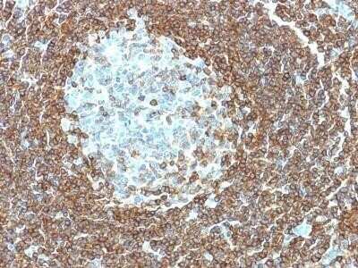 Immunohistochemistry-Paraffin: CD20 Antibody (IGEL/773) [NBP2-44745]