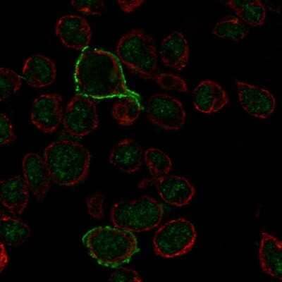 Immunocytochemistry/ Immunofluorescence: CD20 Antibody [NBP1-90051]