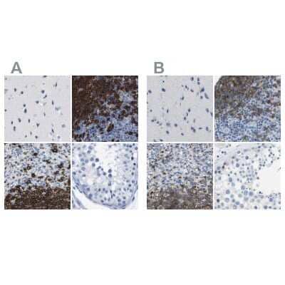 Immunohistochemistry-Paraffin: CD20 Antibody [NBP1-90051]