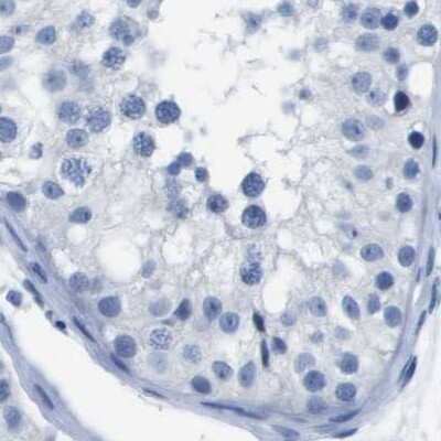 Immunohistochemistry-Paraffin: CD20 Antibody [NBP1-90051]