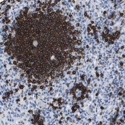 Immunohistochemistry-Paraffin: CD20 Antibody [NBP1-90051]