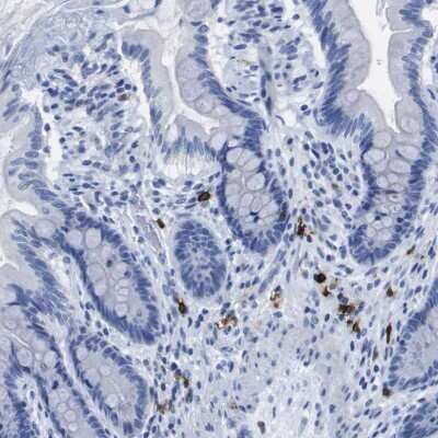 Immunohistochemistry-Paraffin: CD20 Antibody [NBP1-90051]