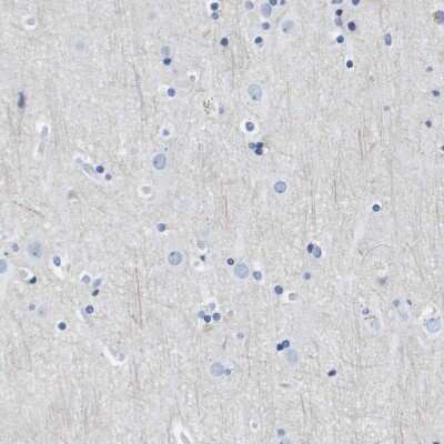 Immunohistochemistry-Paraffin: CD20 Antibody [NBP1-90051]