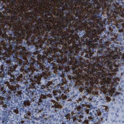 Immunohistochemistry-Paraffin: CD20 Antibody [NBP1-90051]