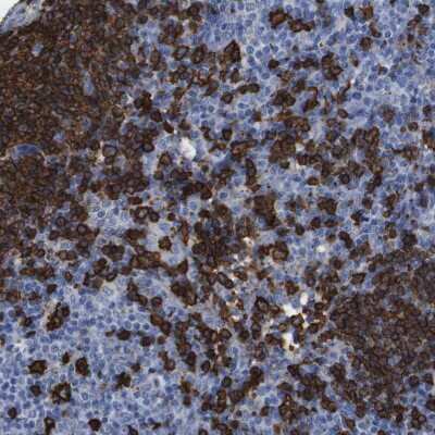 Immunohistochemistry-Paraffin: CD20 Antibody [NBP1-90051]