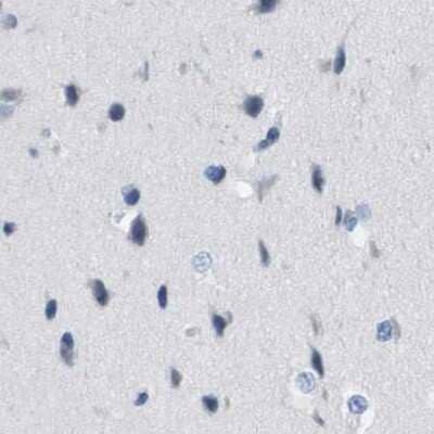 Immunohistochemistry-Paraffin: CD20 Antibody [NBP1-90051]