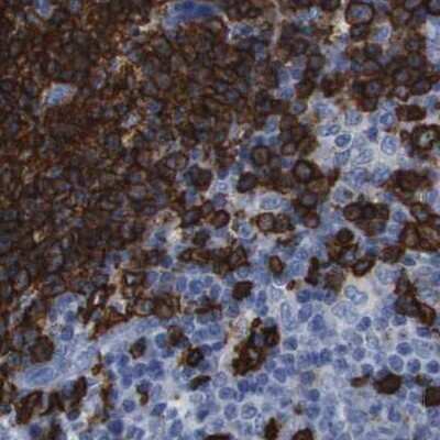 Immunohistochemistry-Paraffin: CD20 Antibody [NBP1-90051]