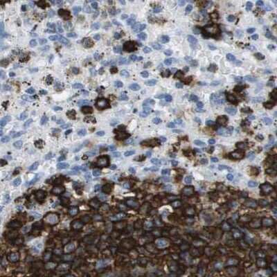 Immunohistochemistry-Paraffin: CD20 Antibody [NBP1-90051]