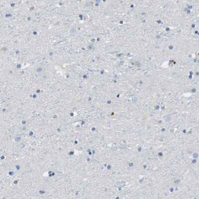 Immunohistochemistry-Paraffin: CD20 Antibody [NBP1-90052]