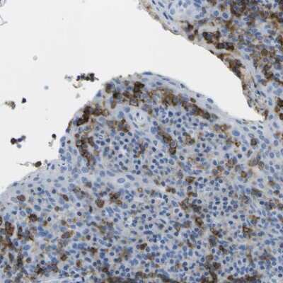 Immunohistochemistry-Paraffin: CD20 Antibody [NBP1-90052]