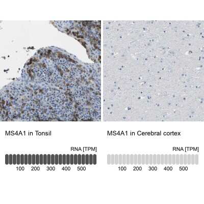 Immunohistochemistry-Paraffin: CD20 Antibody [NBP1-90052]