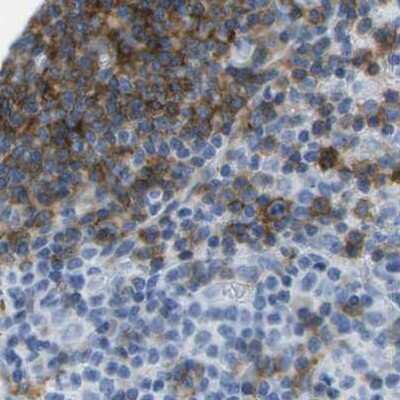 Immunohistochemistry-Paraffin: CD20 Antibody [NBP1-90052]