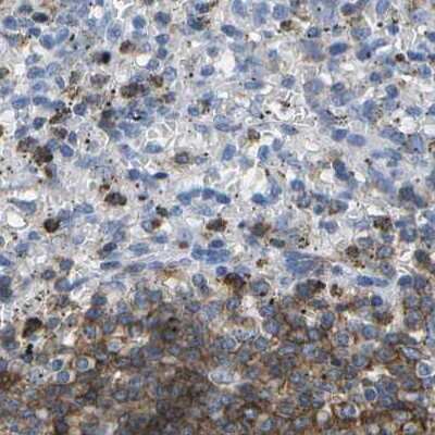 Immunohistochemistry-Paraffin: CD20 Antibody [NBP1-90052]