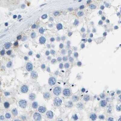 Immunohistochemistry-Paraffin: CD20 Antibody [NBP1-90052]