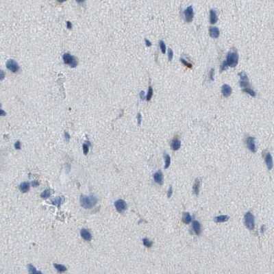 Immunohistochemistry-Paraffin: CD20 Antibody [NBP1-90052]