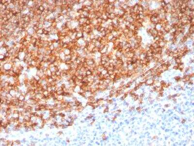 Immunohistochemistry-Paraffin: CD20 Antibody (MS4A1/3410) - Azide and BSA Free [NBP2-78052]