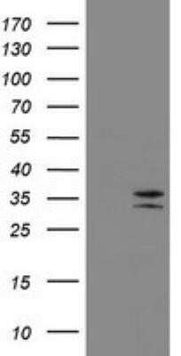 Western Blot: CD20 Antibody (OTI4B4)Azide and BSA Free [NBP2-70362]