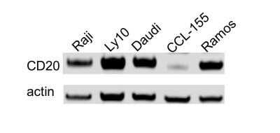 Western Blot: CD20 Antibody (OTI4B4)Azide and BSA Free [NBP2-70362]