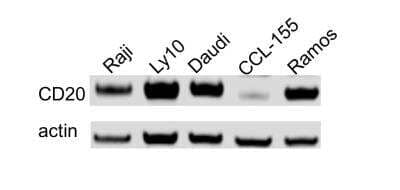 Western Blot: CD20 Antibody (OTI4B4) [NBP2-45454]