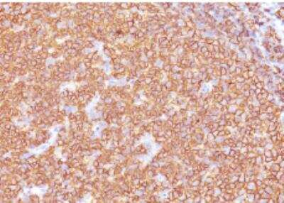 Immunohistochemistry-Paraffin: CD20 Antibody (SPM618) - IHC-Prediluted [NBP2-48336]