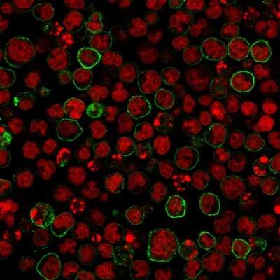 Immunocytochemistry/ Immunofluorescence: CD20 Antibody (SPM618) [NBP2-44746]