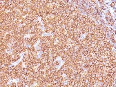 Immunohistochemistry-Paraffin: CD20 Antibody (SPM618) [NBP2-44746]