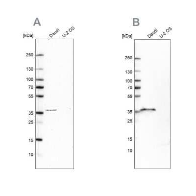 Western Blot: CD20 Antibody [NBP1-90052]