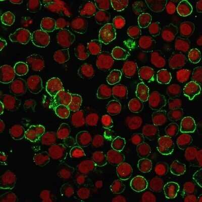 Immunocytochemistry/ Immunofluorescence: CD20 Antibody (rIGEL/773) - Azide and BSA Free [NBP2-54591]