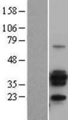 Western Blot: CD20 Overexpression Lysate [NBL1-13311]