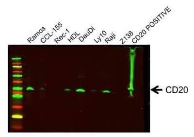 Western Blot: CD20 Overexpression Lysate [NBL1-13312]