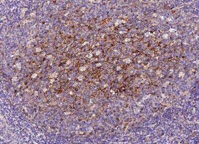 Immunohistochemistry-Paraffin: CD200/OX2 Antibody (333) [NBP2-89696]