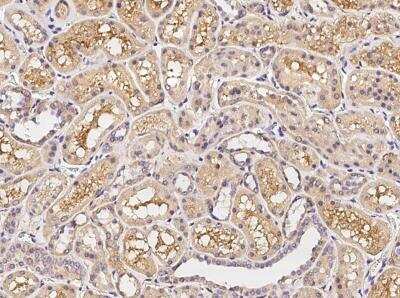 Immunohistochemistry-Paraffin: CD200/OX2 Antibody (333) [NBP2-89696]