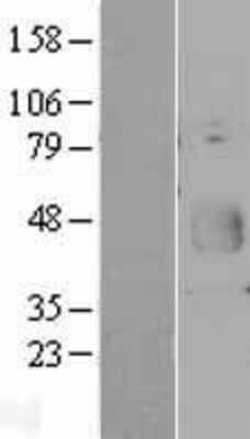 Western Blot: CD200/OX2 Overexpression Lysate [NBP2-04304]