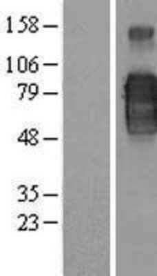 Western Blot: CD200R1 Overexpression Lysate [NBP2-05208]