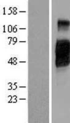 Western Blot: CD200R1 Overexpression Lysate [NBP2-05624]