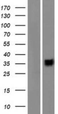 Western Blot: CD200R1L Overexpression Lysate [NBP2-08799]