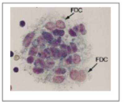 Immunohistochemistry: CD21 Antibody (7D6) [DDX0120P-100]
