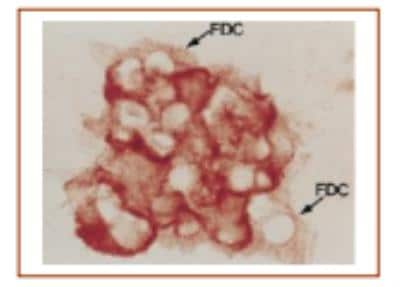 Immunohistochemistry: CD21 Antibody (7D6) [DDX0120P-100]