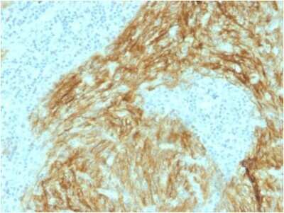 Immunohistochemistry-Paraffin: CD21 Antibody (CR2/1952) - Azide and BSA Free [NBP2-60733]