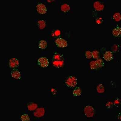 Immunocytochemistry/ Immunofluorescence: CD21 Antibody (CR2/3124R) - Azide and BSA Free [NBP3-08297]