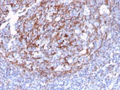 Immunohistochemistry-Paraffin: CD21 Antibody (CR2/3124R) [NBP3-07754]